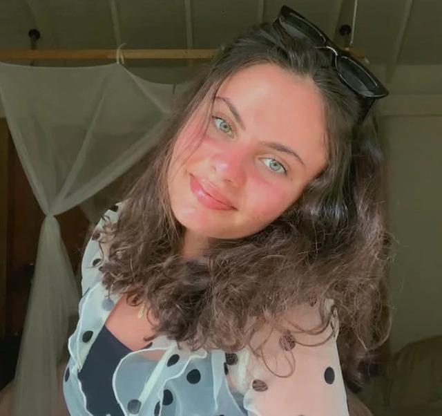 Why This Woman Quit Washing Her Face—and The Shocking Skin Transformation Everyone’s Talking About